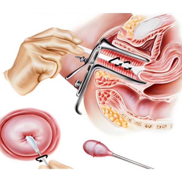 پاپ اسمیر در مشهد / کلینیک پرنیان
