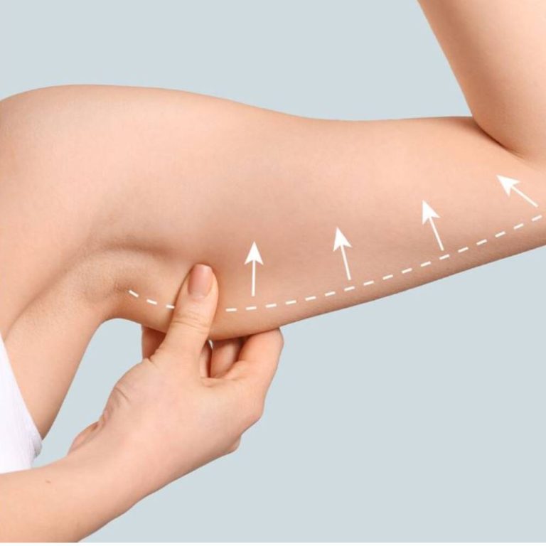 عمل زیبایی بازو در مشهد/ کلینیک پرنیان