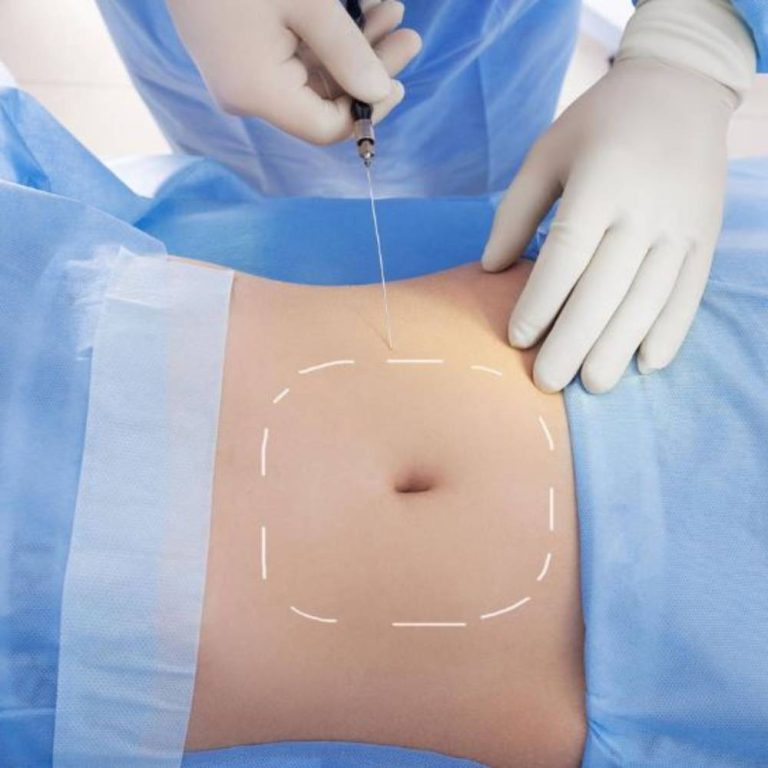 پیکرتراشی در مشهد