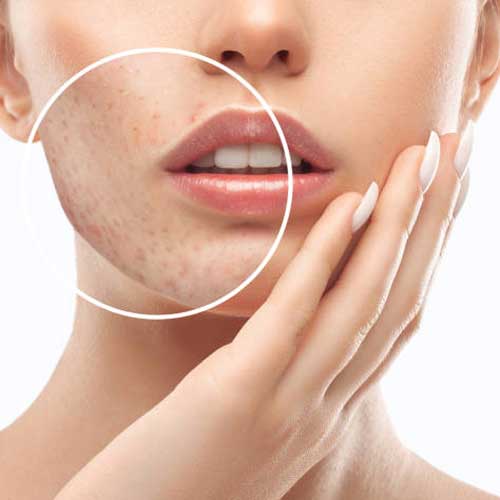 عوارض جبران ناپذیر در صورت استفاده نکردن از کرم ترمیم کننده بعد از لیزر موهای زائد