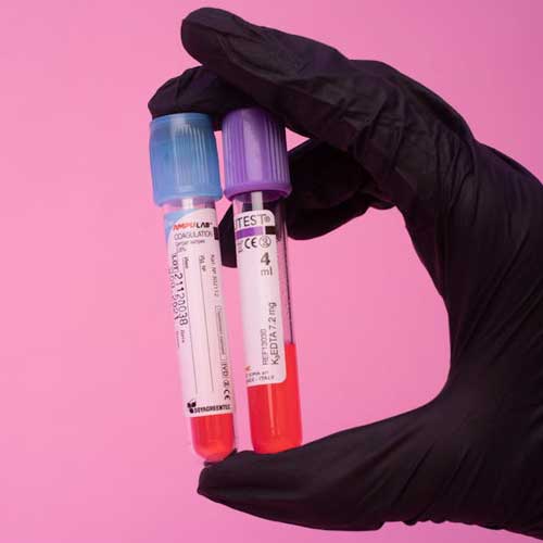 عوارض جانبی واکسن گارداسیل