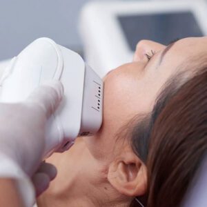 جوش زدن بعد از لیزر