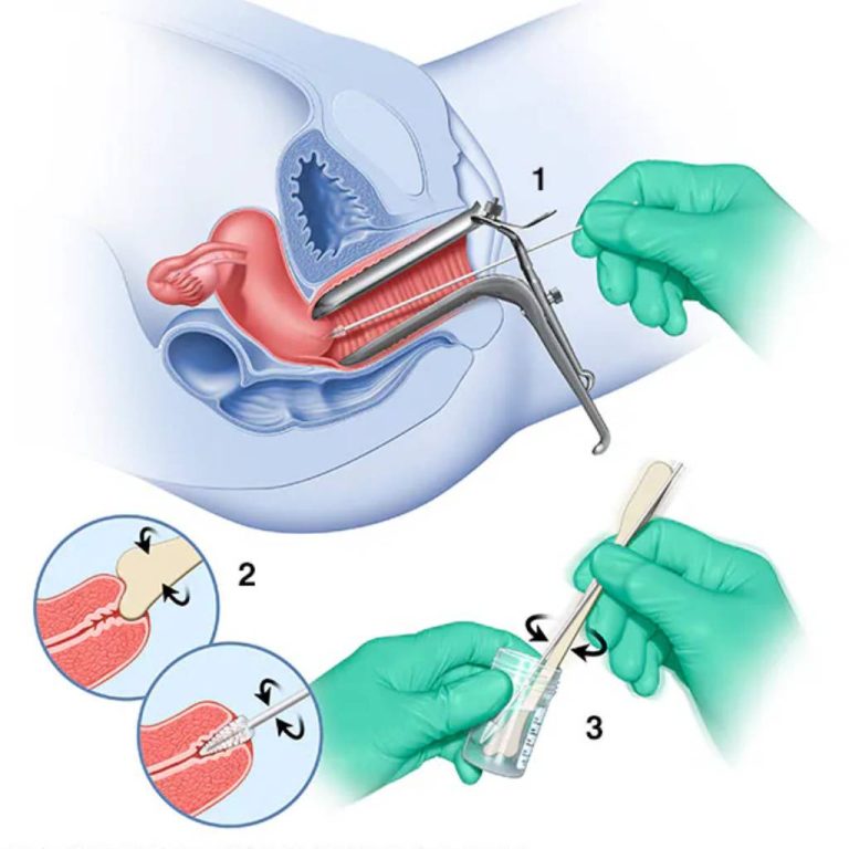 قرار دادن آی دی یو IDU در مشهد