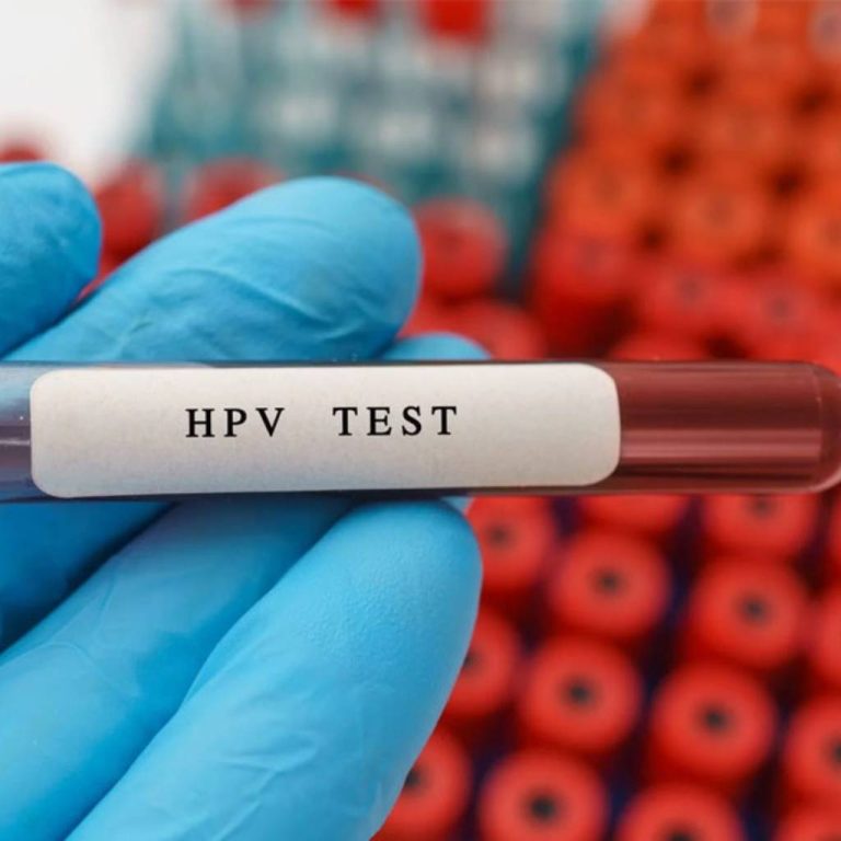 تست HPV در مشهد