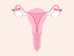 درمان خشکی واژن در مشهد