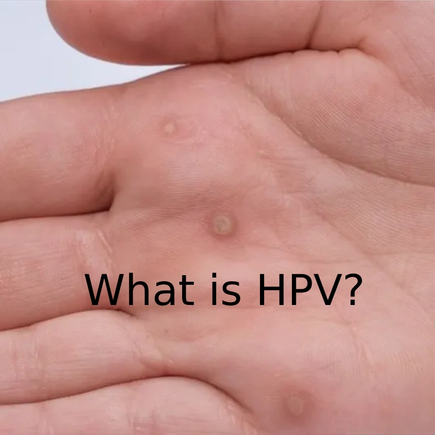 تاریخچه بیماری HPV: همه چیز درباره راه های تشخیص و درمان در مشهد