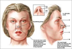 عمل جراحی بینی در مشهد
