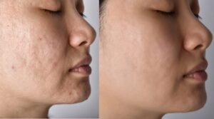 سابسیژن در مشهد