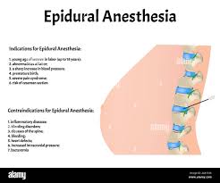 زایمان بدون درد با اپیدورال در مشهد تحت نظر دکتر رزیتا داوودی