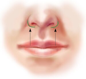 سانترال لب در مشهد