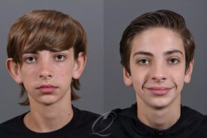 جراحی زیبایی گوش در مشهد