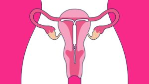 قرار دادن آی دی یو IDU در مشهد