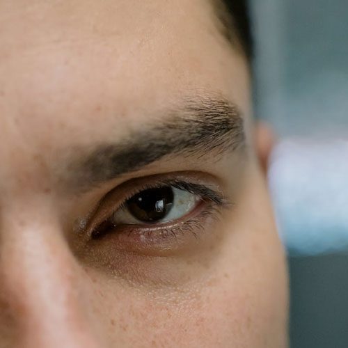 اثرات افتادگی پلک بر زندگی افراد