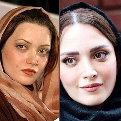 بازیگران ایرانی معروف که جراحی زیبایی انجام داده اند