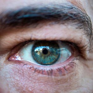 علت افتادگی پلک + عوارض خطرناک اگر عمل جراحی انجام نشود