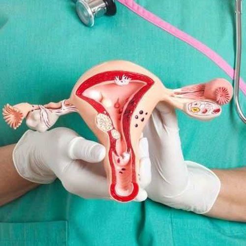 مهم ترین عوامل موثر در سرطان رحم