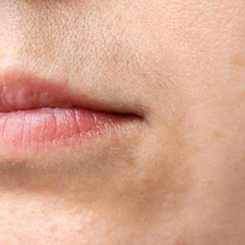 نشانه بالا رفتن تستسترون زنان نمد در پر مویی و رشد مو زیر لب