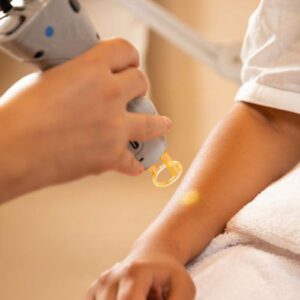 بهترین دستگاه لیزر برای موهای هورمونی