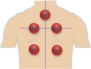 حجامت و فصد خون در مشهد