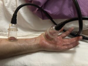 حجامت و فصد خون در مشهد