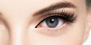 بوتاکس چشم گربه ای