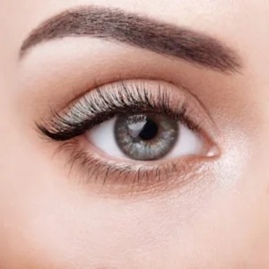 تزریق بوتاکس چشم گربه ای در مشهد