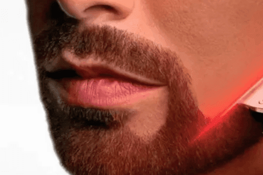 نتیجه لیزر خط ریش آقایان با پوستی صاف و خط ریشی مرتب