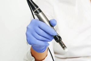 دستگاه پیشرفته لیزر لابیاپلاستی در کلینیک پرنیان