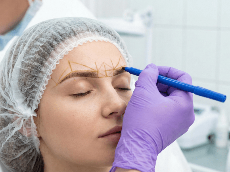 طراحی مهندسی شده و قرینه‌سازی ابرو قبل از کاشت در کلینیک پرنیان