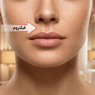 فیلتروم چیست : نمای نزدیک از صورت یک زن جوان با فاصله استاندارد و زیبای بین بینی و لب (فیلتروم) در کلینیک زیبایی
