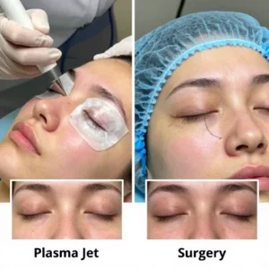 پلاسما جت پلک یا جراحی